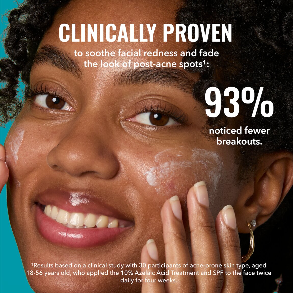 10-azelaic-acid-treatment-k8 zb_p.jpg