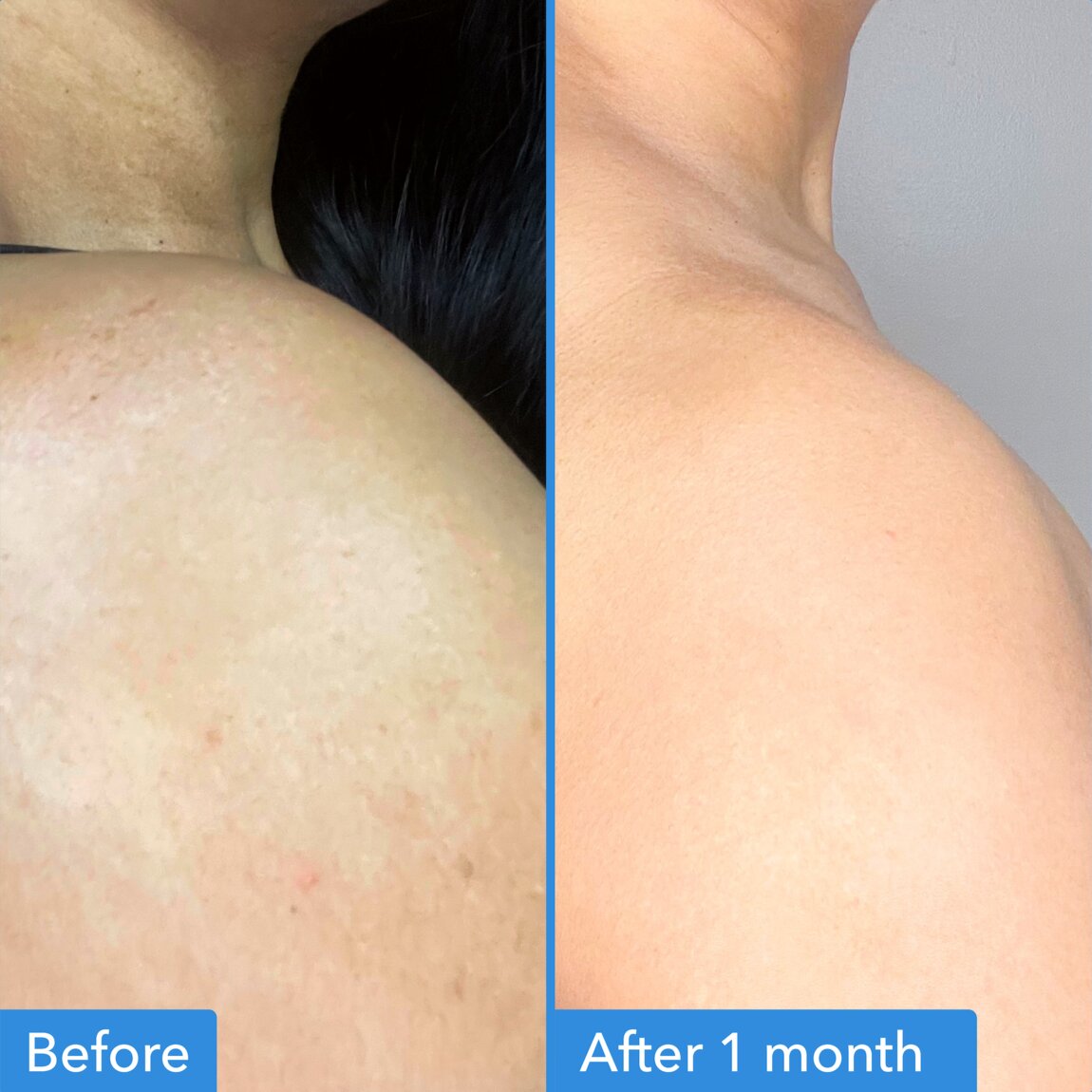 discoloration-correcting-body-treatment-z5 zb_p.jpg