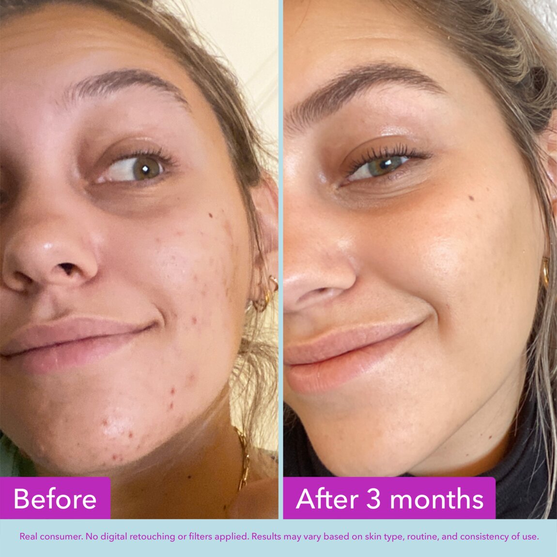 niacinamide-brightening-toner-f6 zb_p.jpg