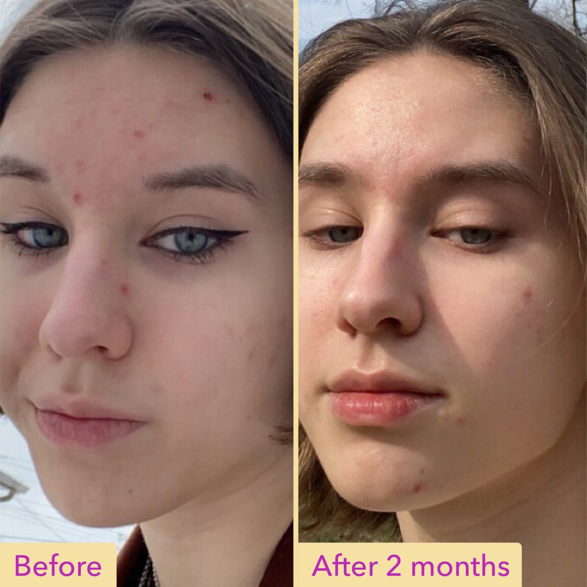 niacinamide-serum-o9 zb_p.jpg